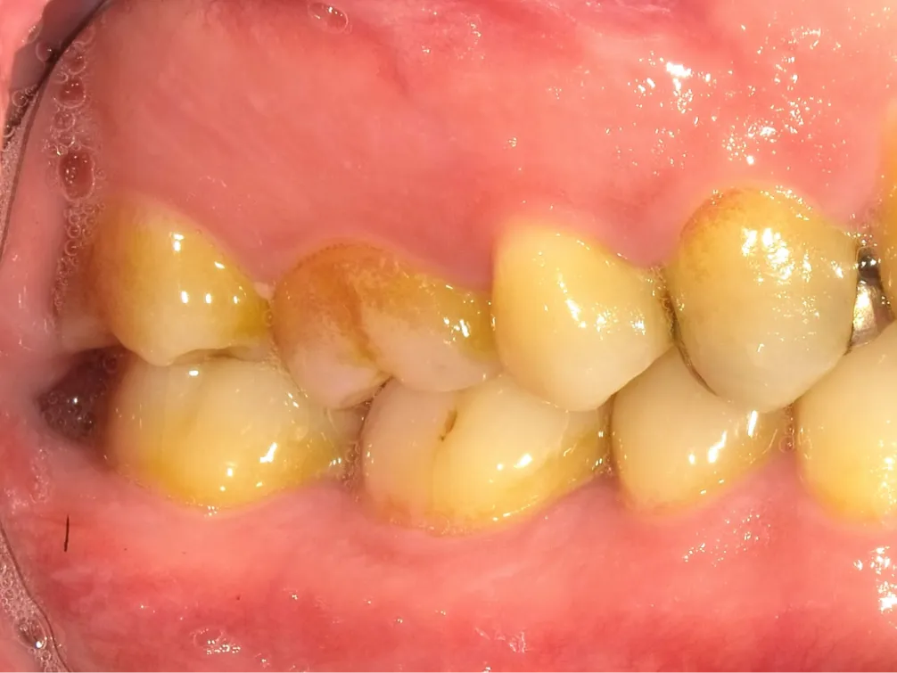CASE08