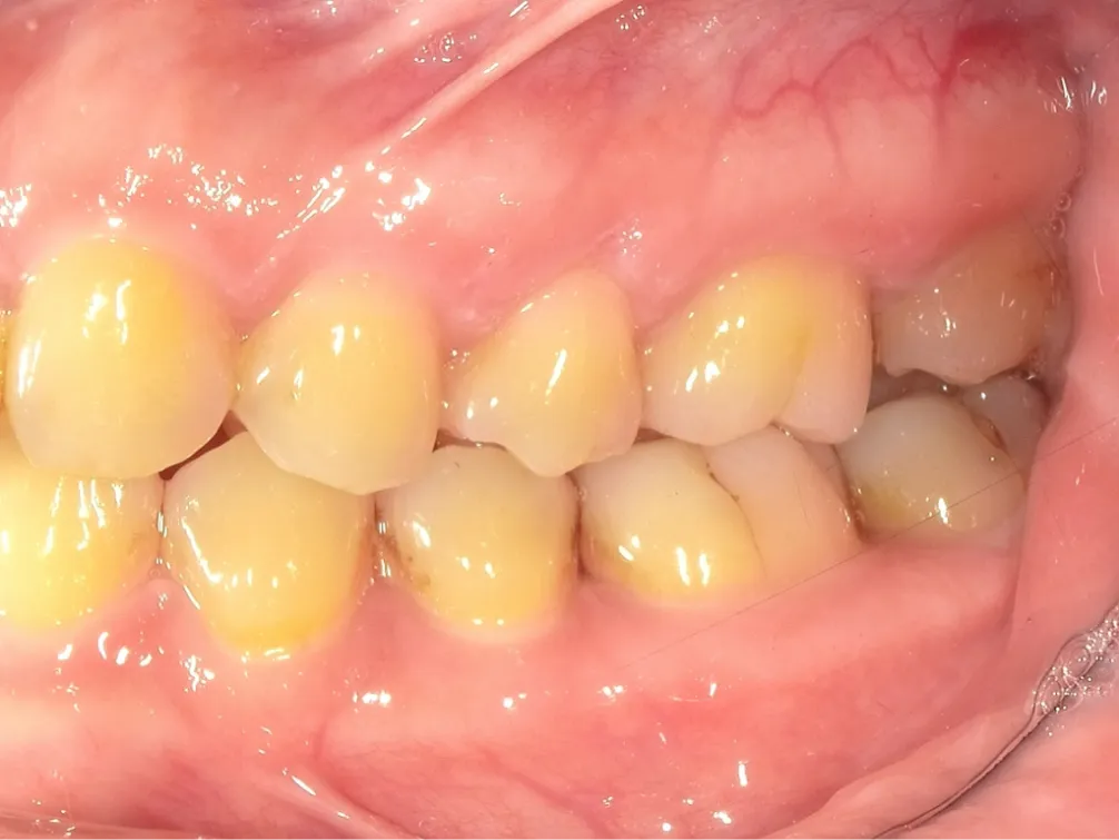 CASE07
