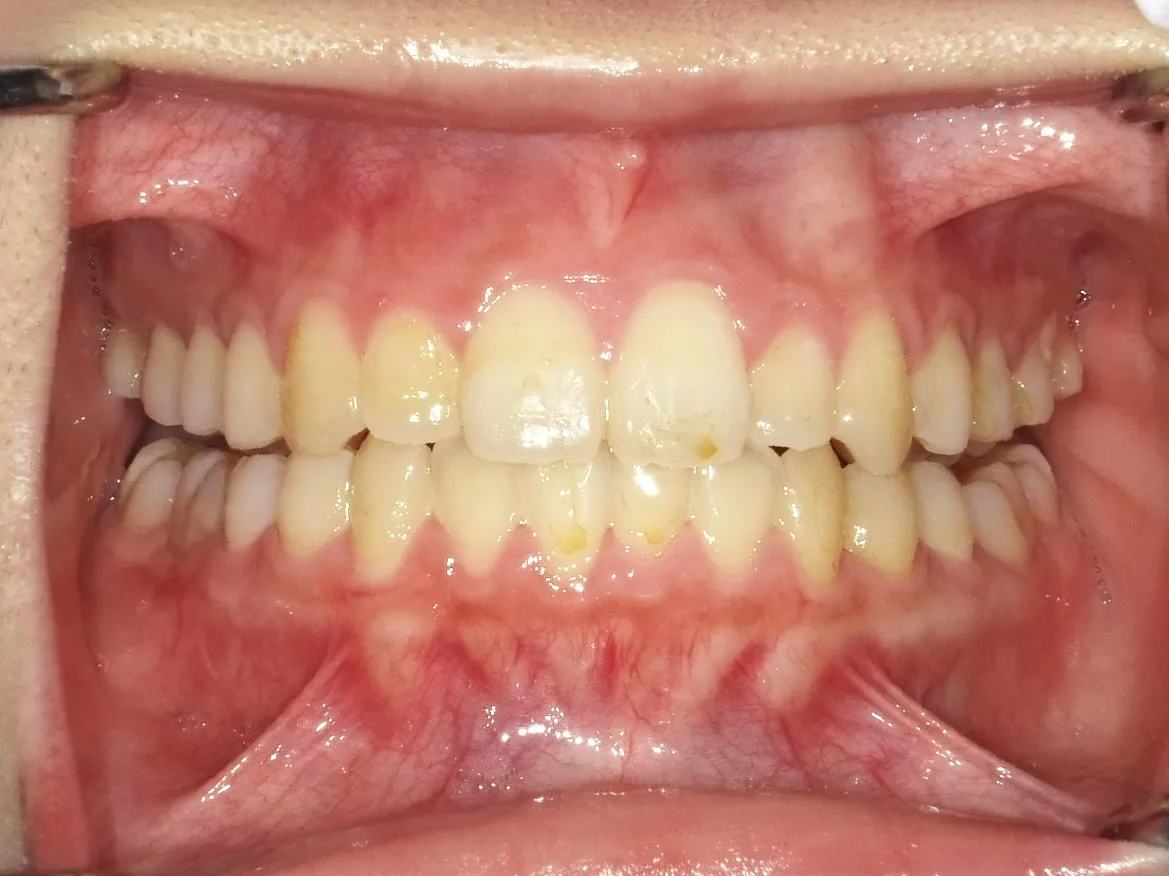 CASE04