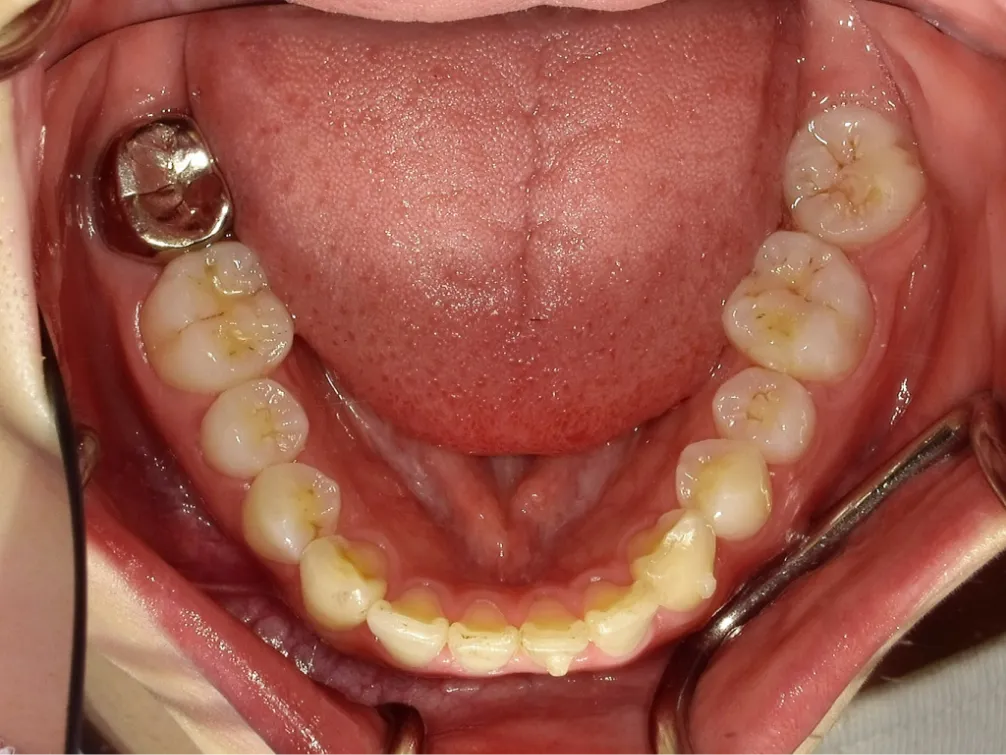 CASE06