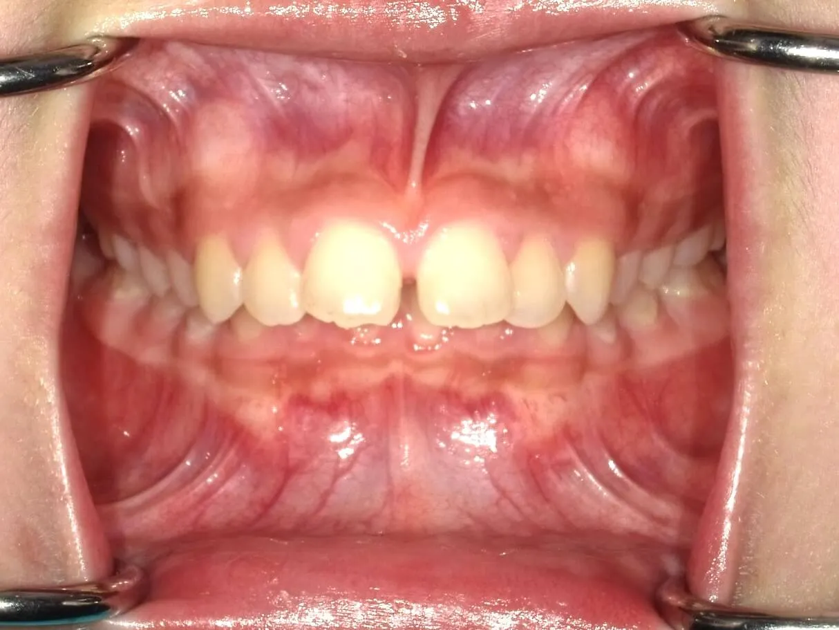 CASE04