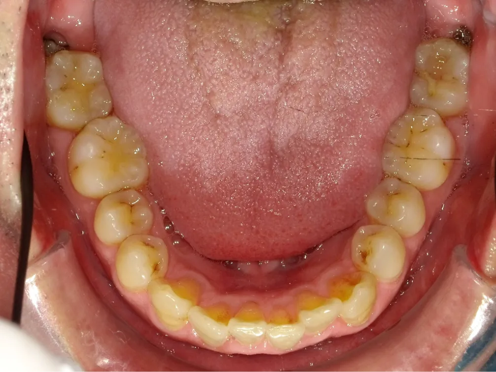 CASE08