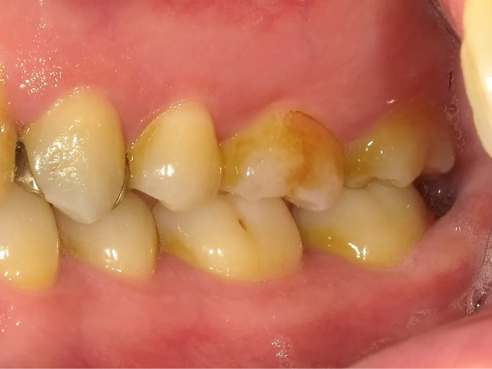 CASE08