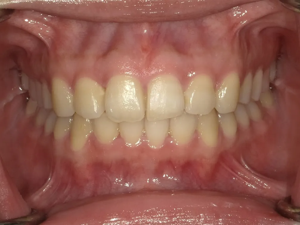 CASE24
