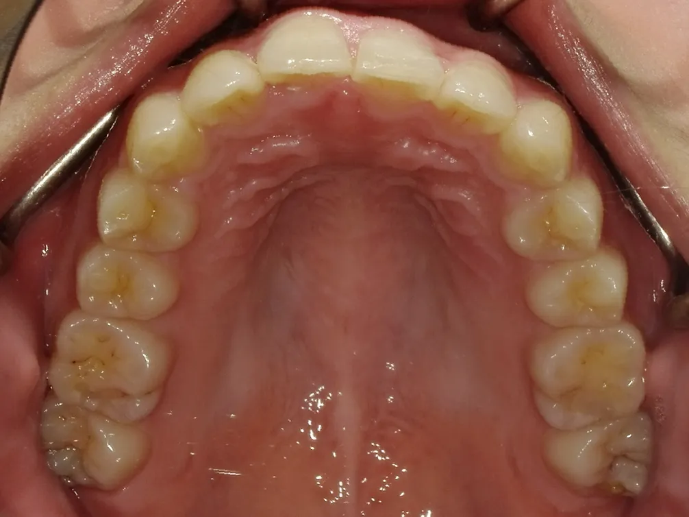 CASE24