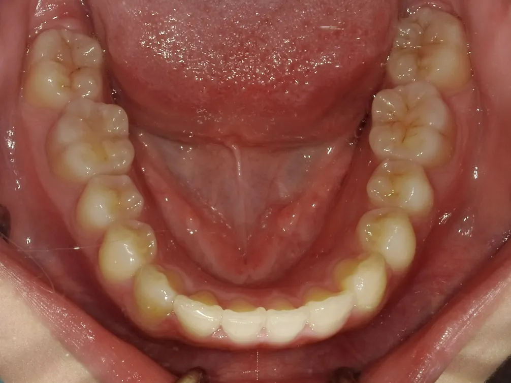 CASE24