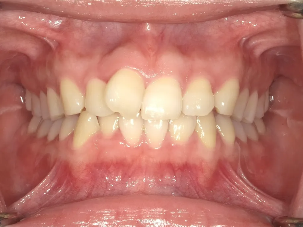 CASE24