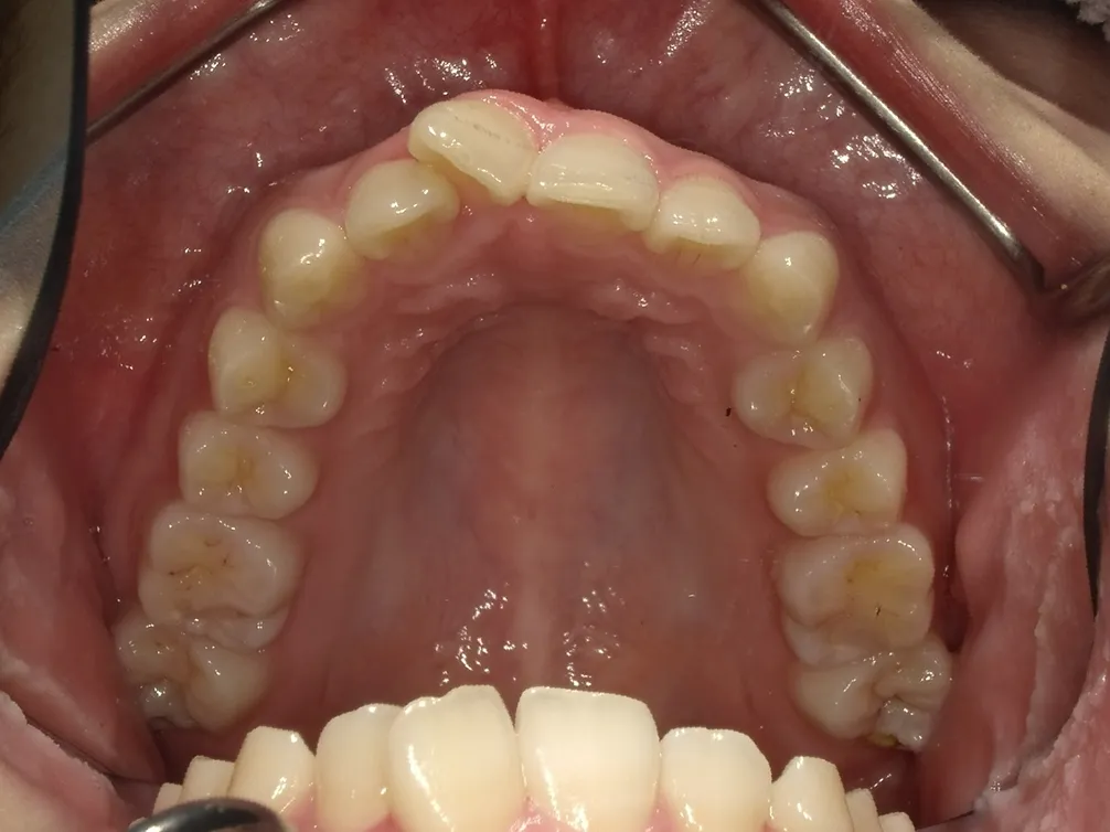 CASE24