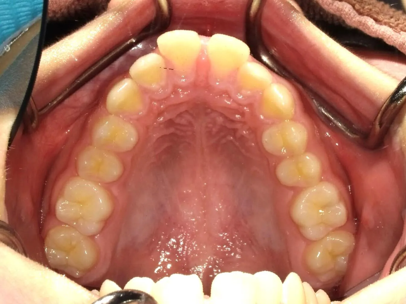 CASE04