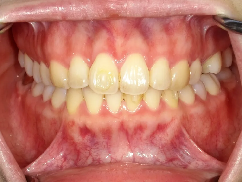 CASE06