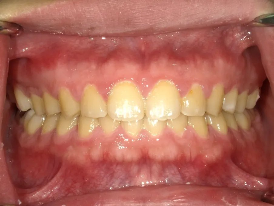 CASE10