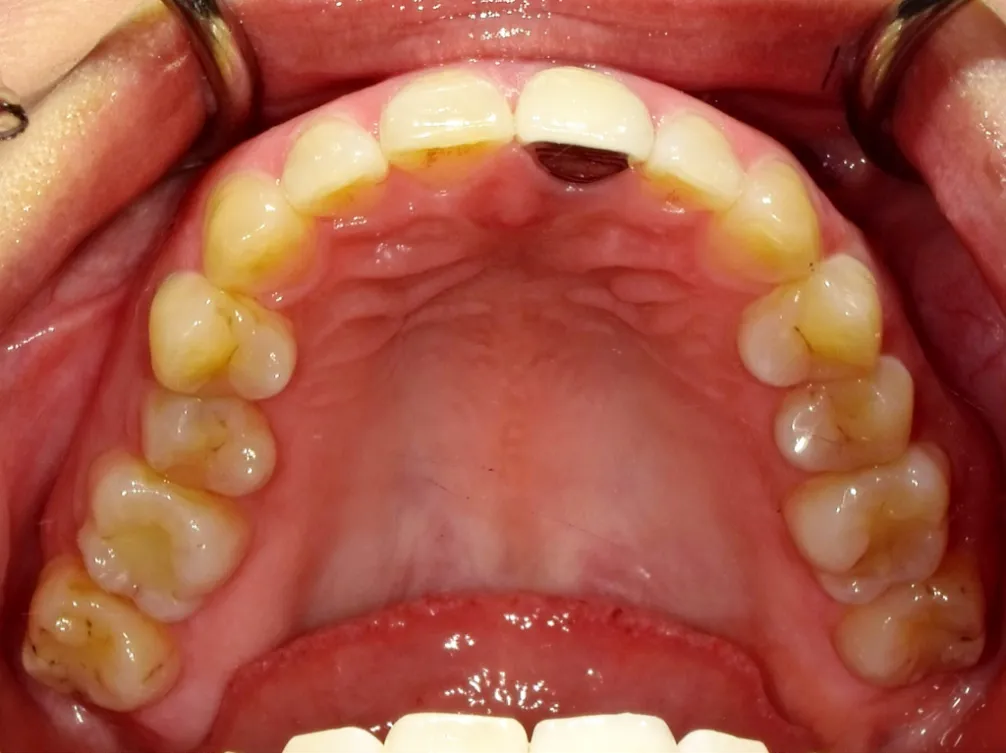 CASE09