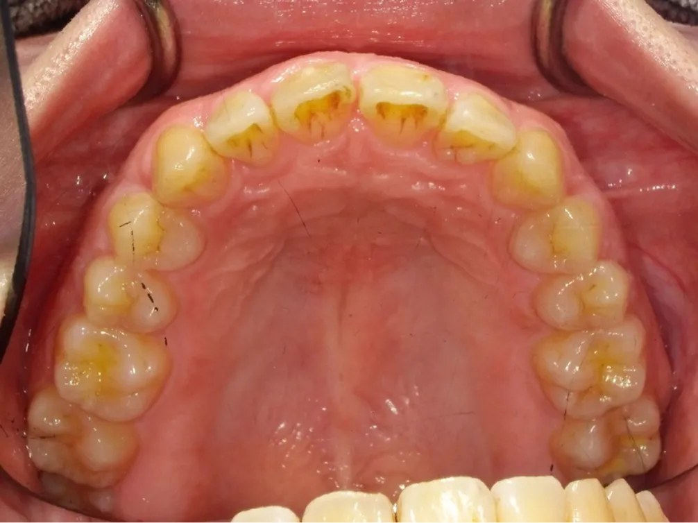 CASE07