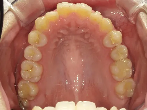 CASE04