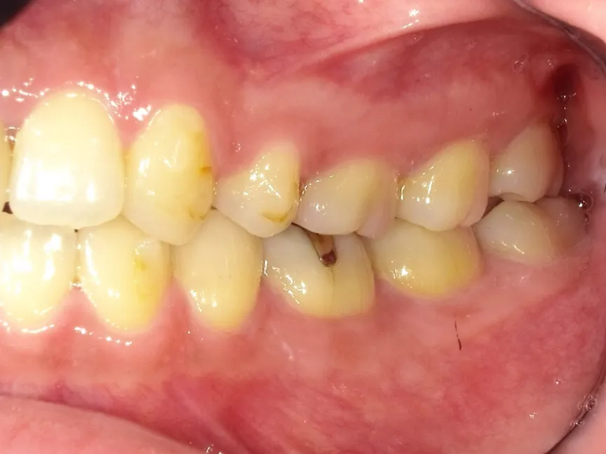 CASE16