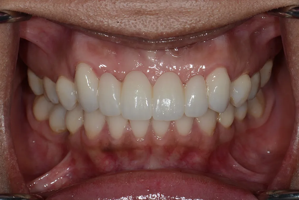 CASE18