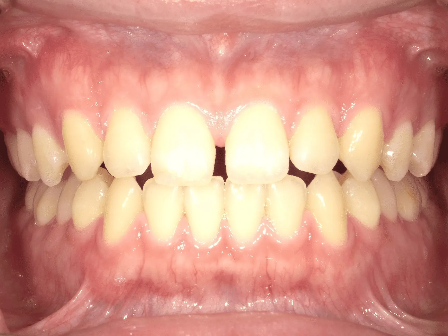 CASE12