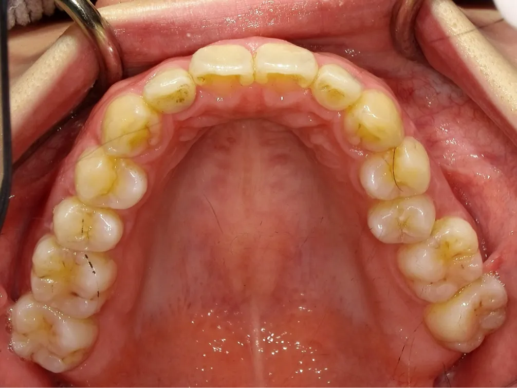 CASE06