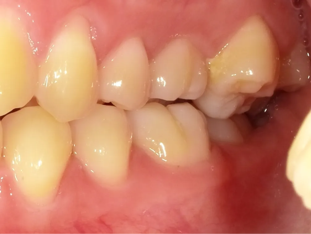 CASE10