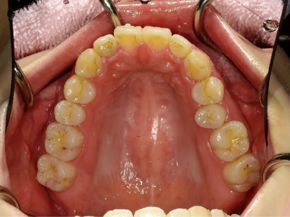CASE08