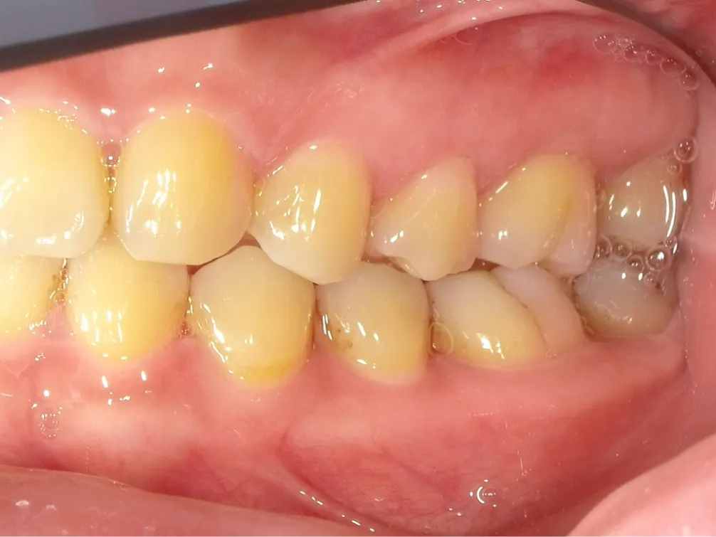 CASE07