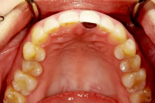 CASE04