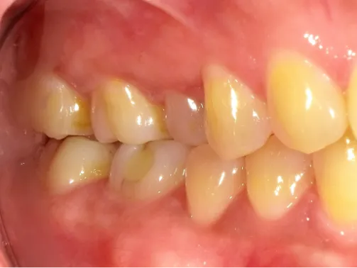 CASE09