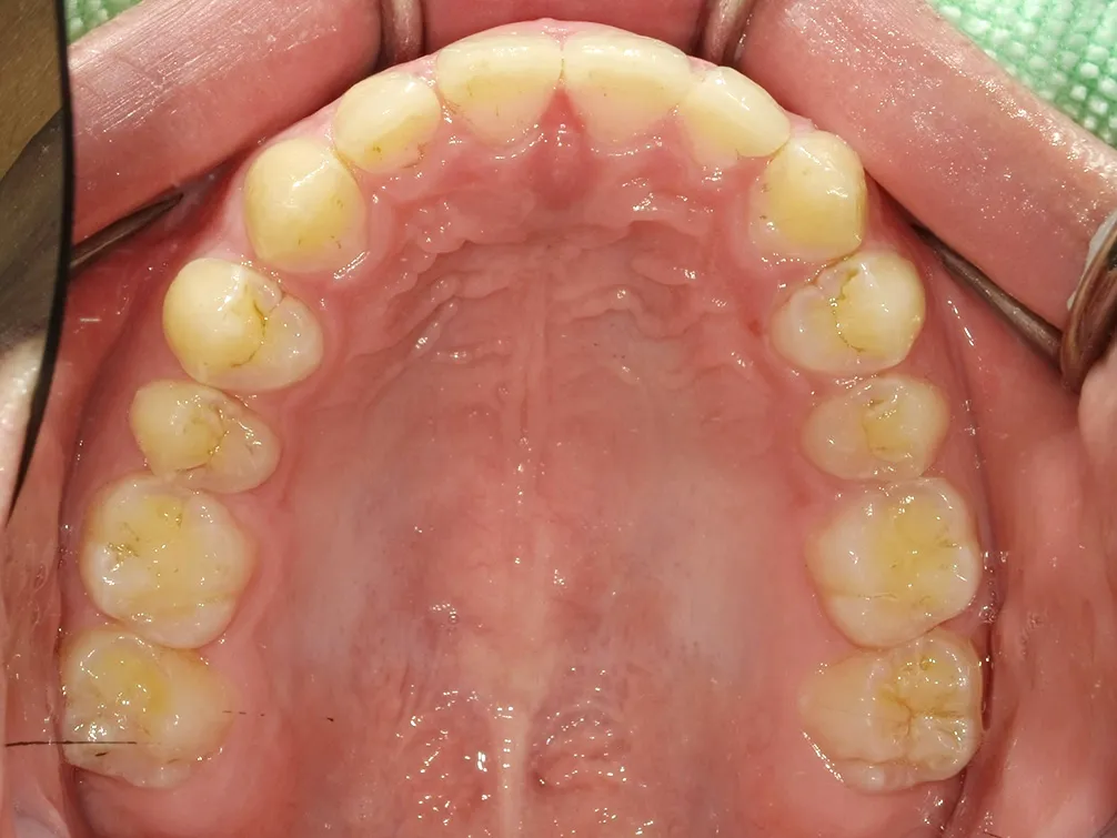 CASE12
