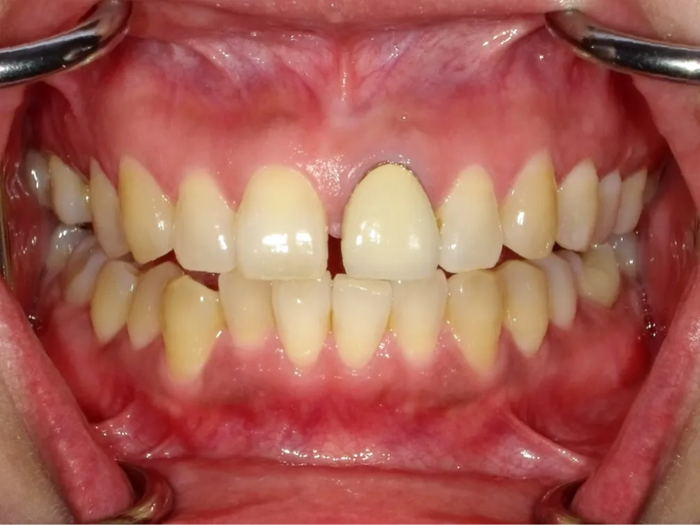 CASE09