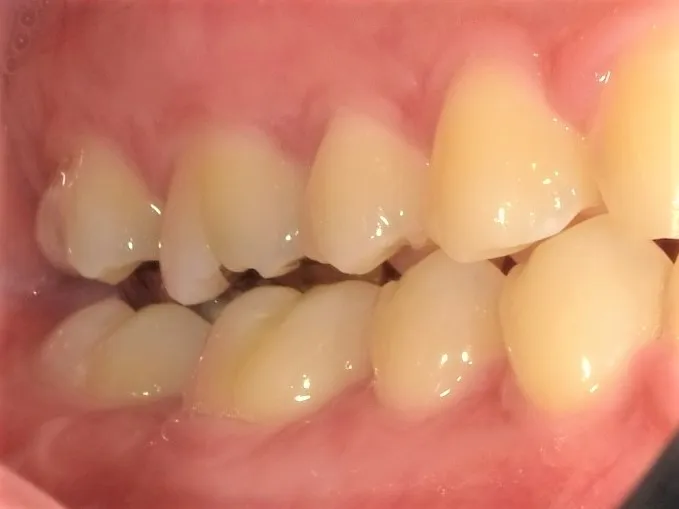 CASE21