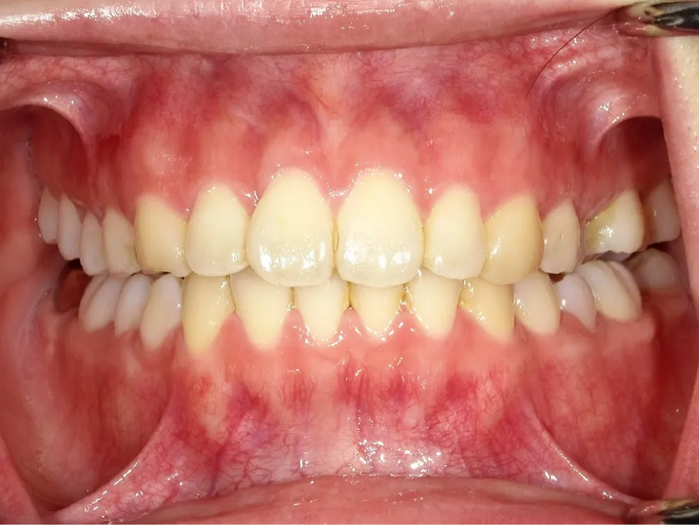 CASE06