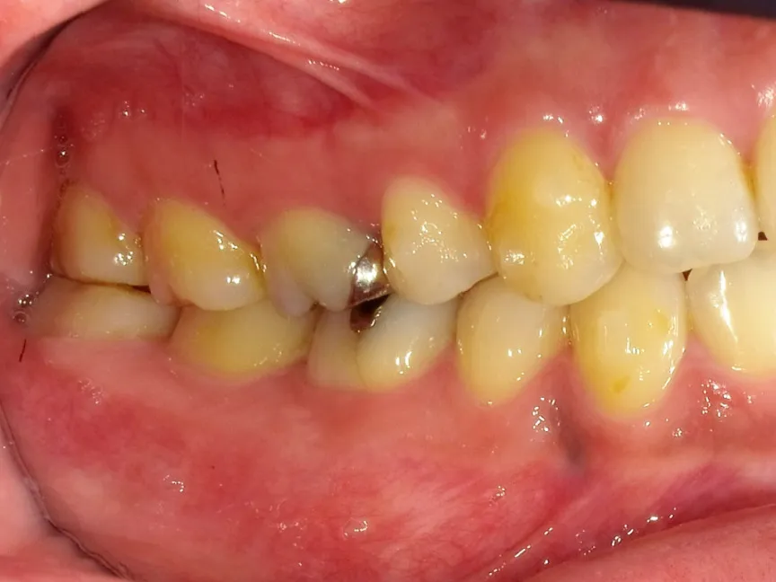 CASE16