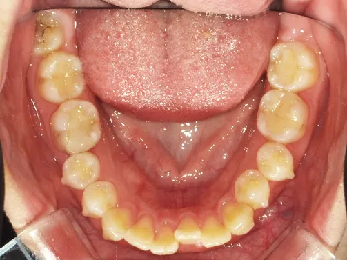 CASE04