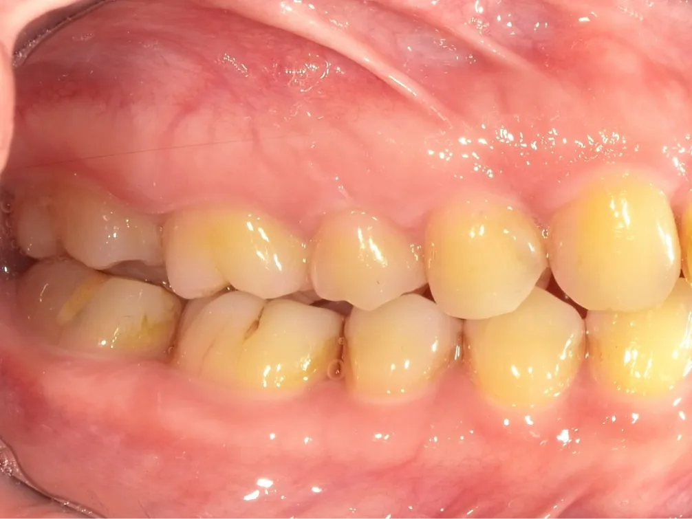CASE07