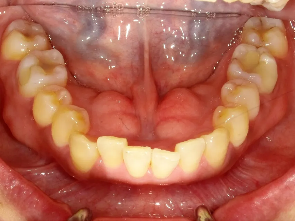 CASE09