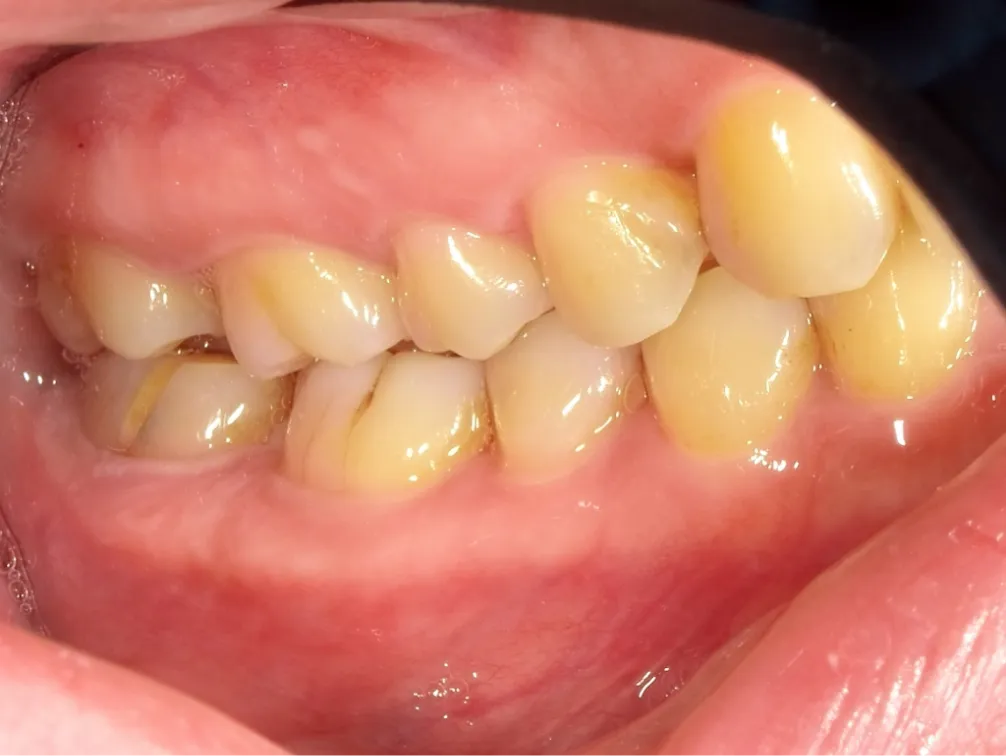 CASE07