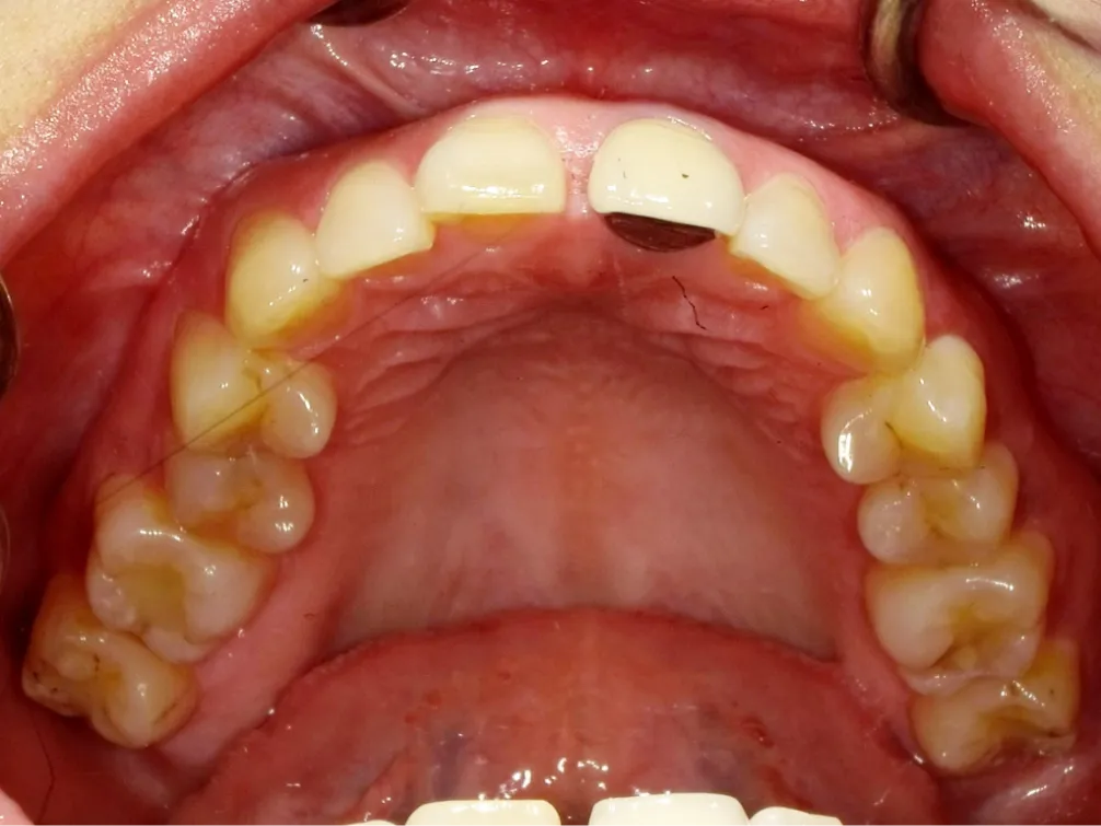 CASE09