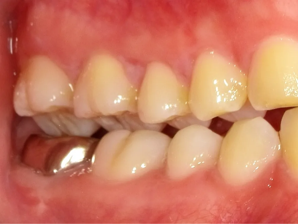 CASE06