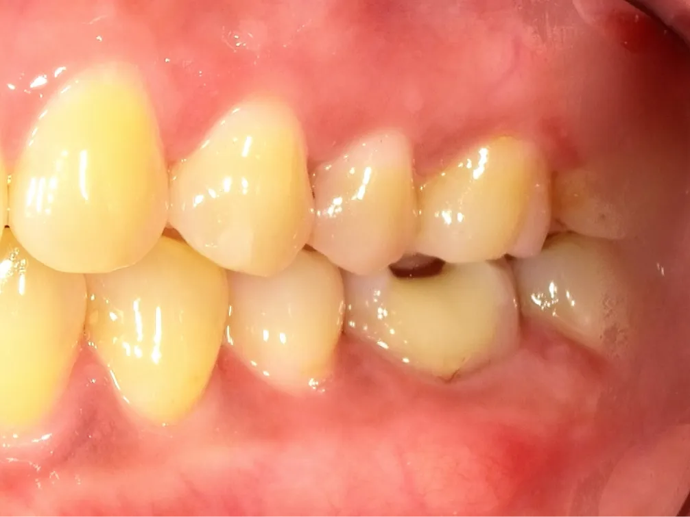 CASE09