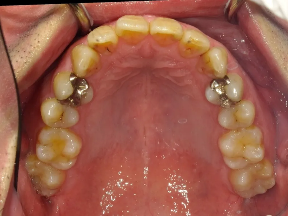 CASE08