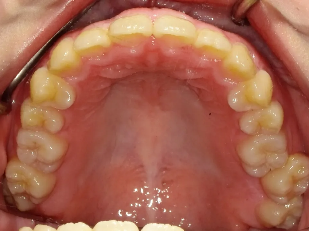 CASE10