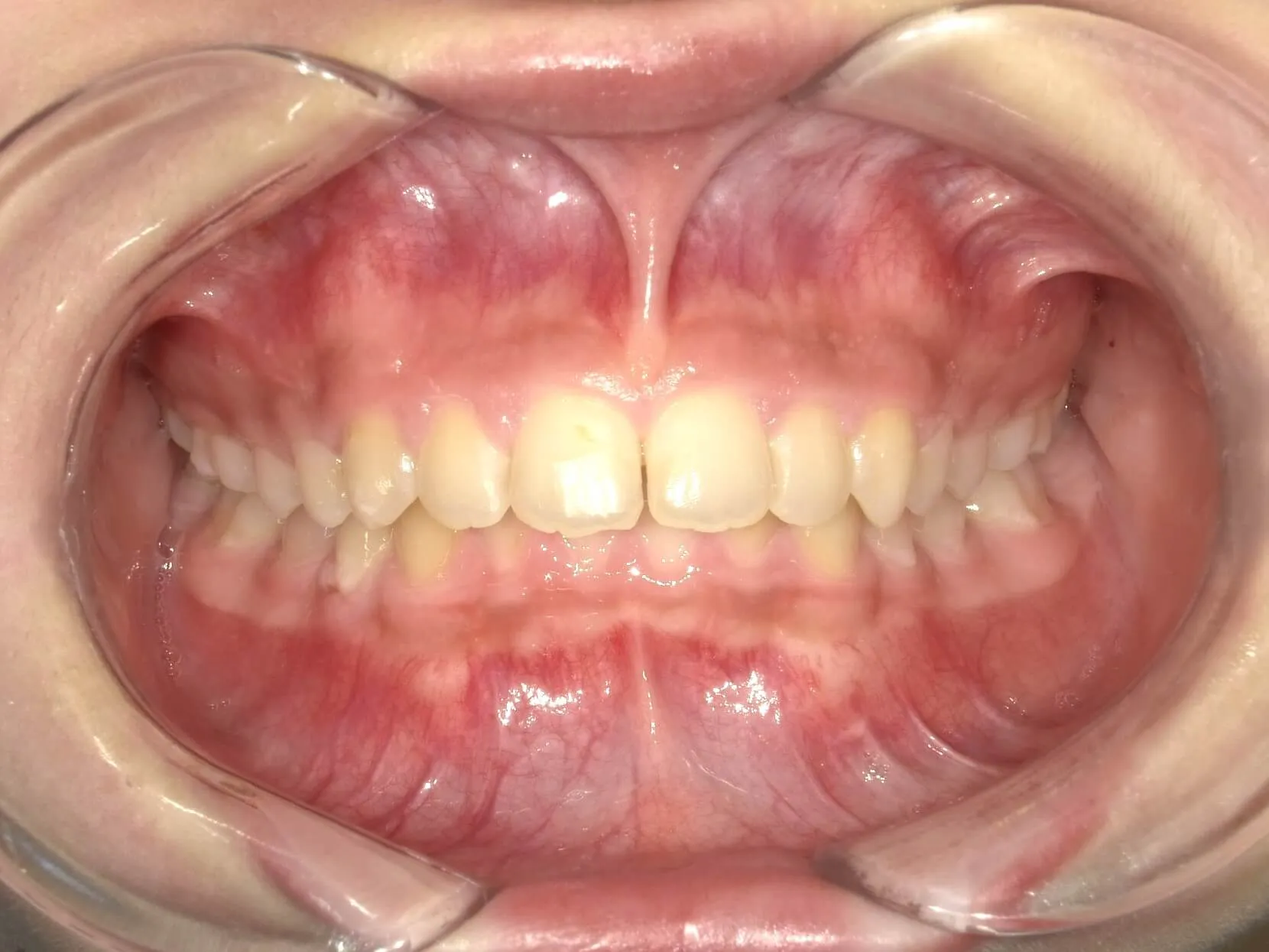 CASE04
