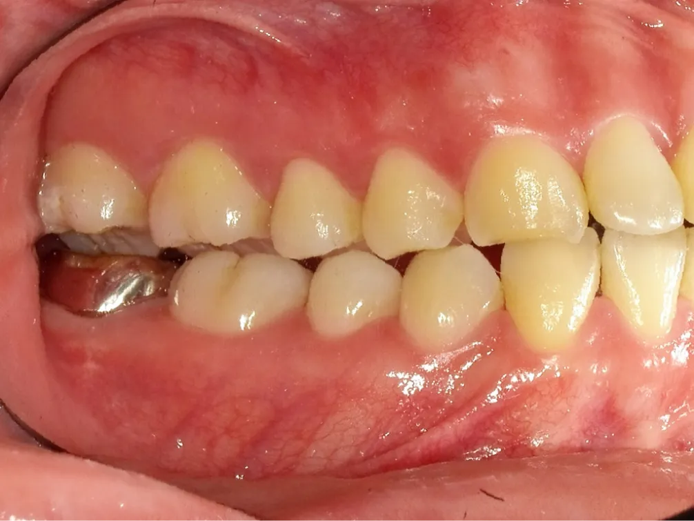 CASE06