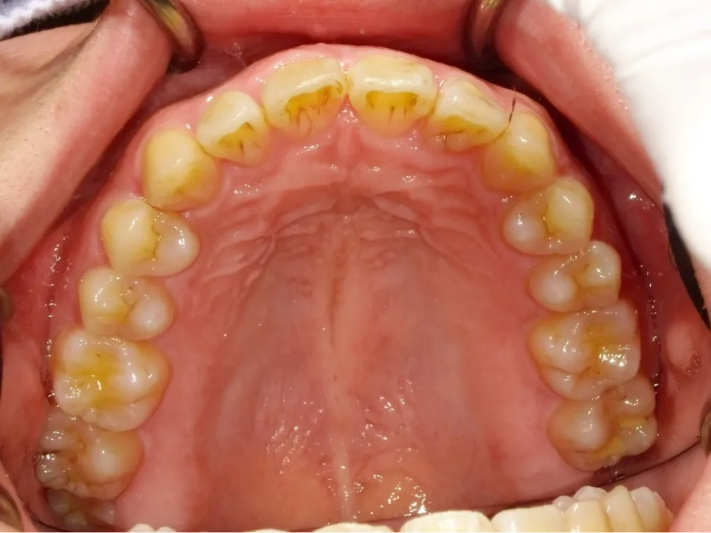 CASE07