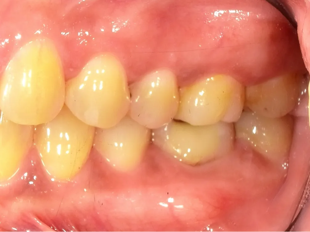 CASE09