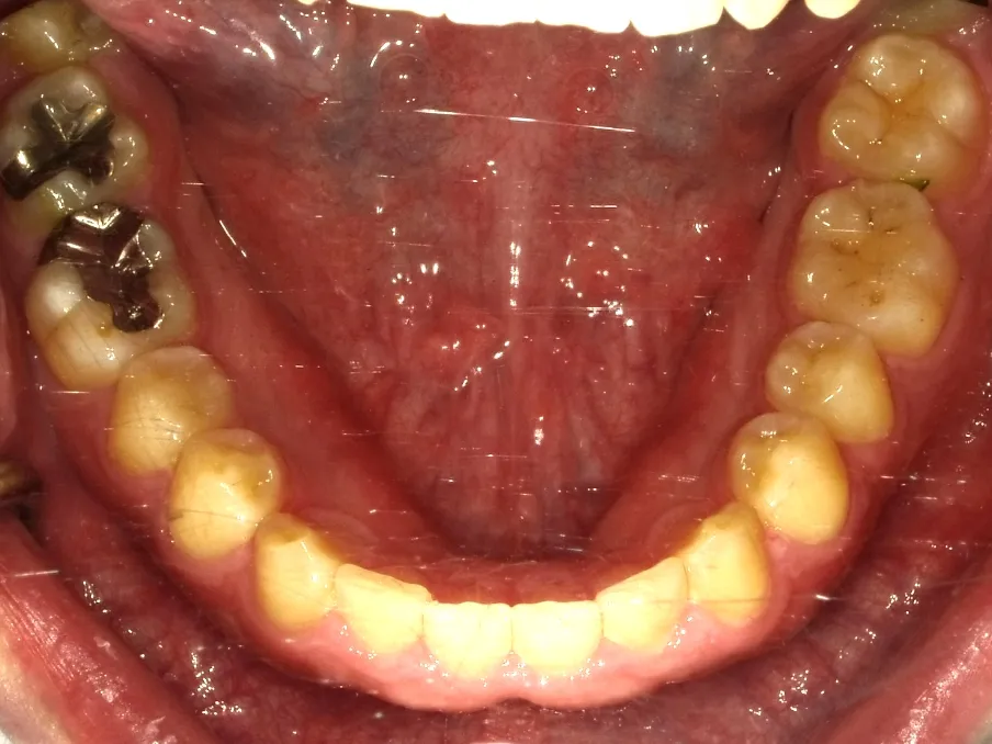 CASE10