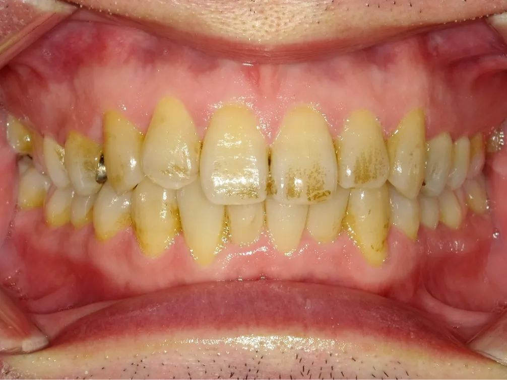 CASE08
