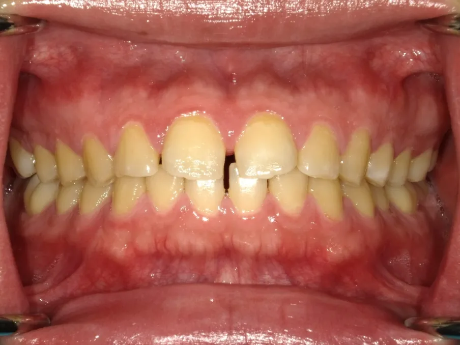 CASE10