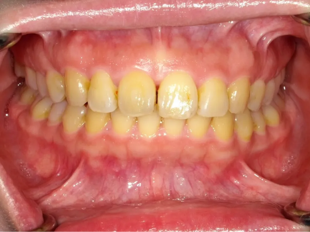 CASE07