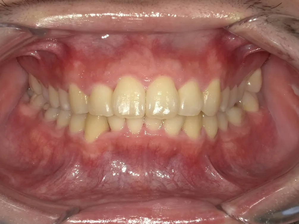 CASE5